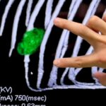 悪性腫瘍で『骨を３本失った犬』…手術から２週間後→まるで嘘のような『８歳を迎えた光景』に感動「よく頑張った…！」「泣けてくる」の声(ブログ)