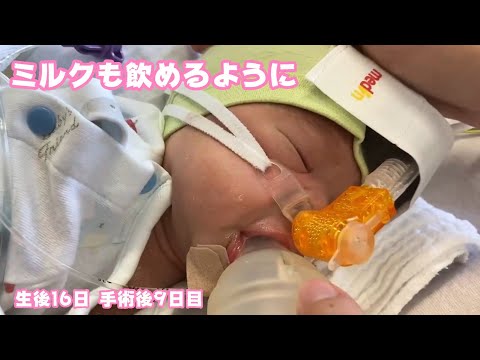 ミルクも飲めるようになってます  生後16日  心臓外科手術後9日目  ばぁちゃんは今日で一旦バイバイです  2026 01 29 2(YouTube)