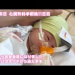 生後17日  心臓外科手術後11日目  明日からママパパはオウチから通えます  順調ですよ～   2026 01 31 2(YouTube)
