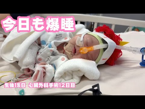 今日も爆睡です  生後18日 心臓外科手術から12日目  2026 02 02 2(YouTube)